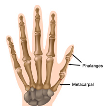 Infection In Bone Symptoms Infection In Bone Symptoms