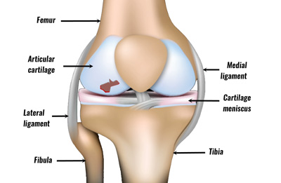Articular Cartilage Injury | Symptoms & treatment split femur diagram 