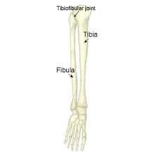 Proximal Tibiofibular Joint Dislocation | symptoms and treatment ...