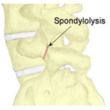 Virtual Sports Injury Clinic