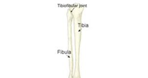 Proximal Tibiofibular - Dislocation