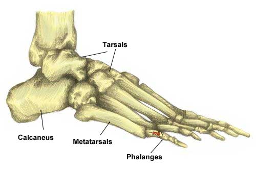 Broken toe