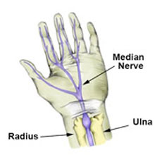 Median nerve injury