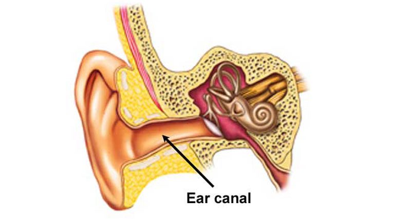 Swimmers ear