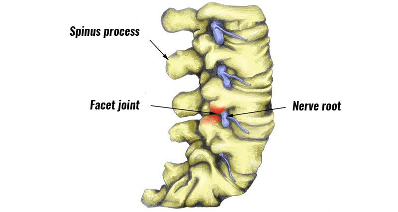 Facet joints