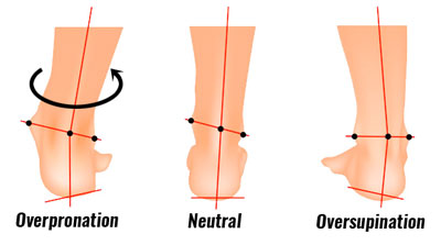 Foot biomechanics and tibial stress fracture