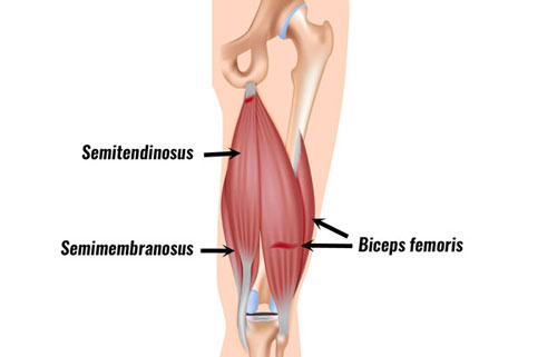 The action of the hamstring muscles is: a. flexion of the knee and