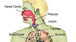 Fractured larynx