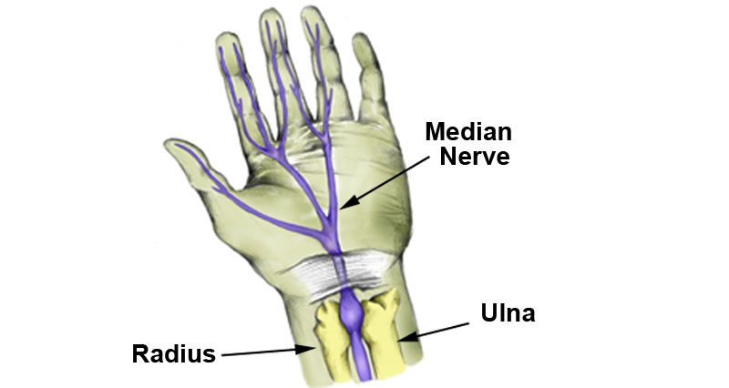 Ulnar Nerve Pain In Hand Relief - Kuroi