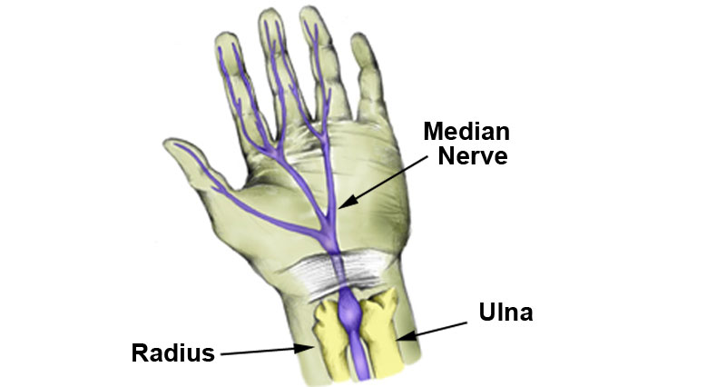 Median nerve injury