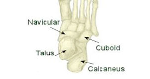 Midtarsal Joint Sprain