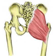 Myofascial Pain - Buttock