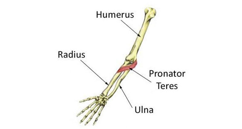 Pronator teres syndrome