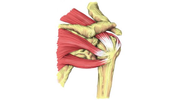 Rotator cuff strain