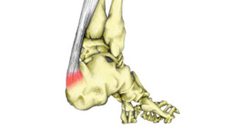 Рубрика: Artroza centrului piciorului Cu artroza articulației gleznei