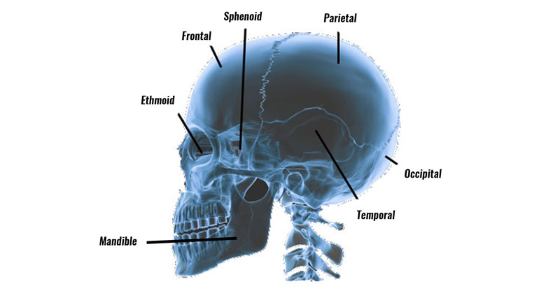 Skull fracture