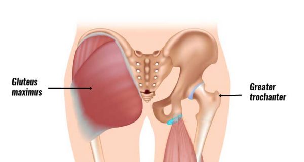 Snapping hip anatomy
