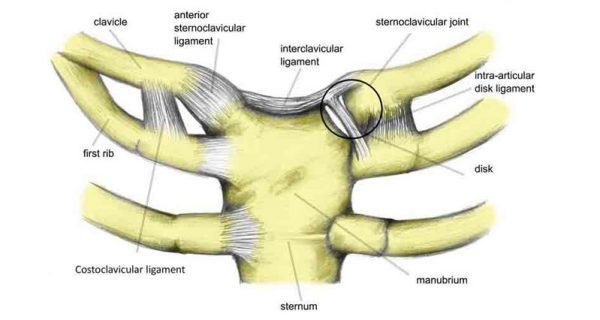 Sternoclavicular injury