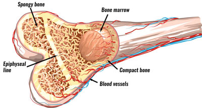 Slipped capital femoral epiphysis