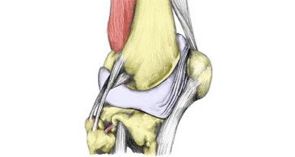 Synovial plica