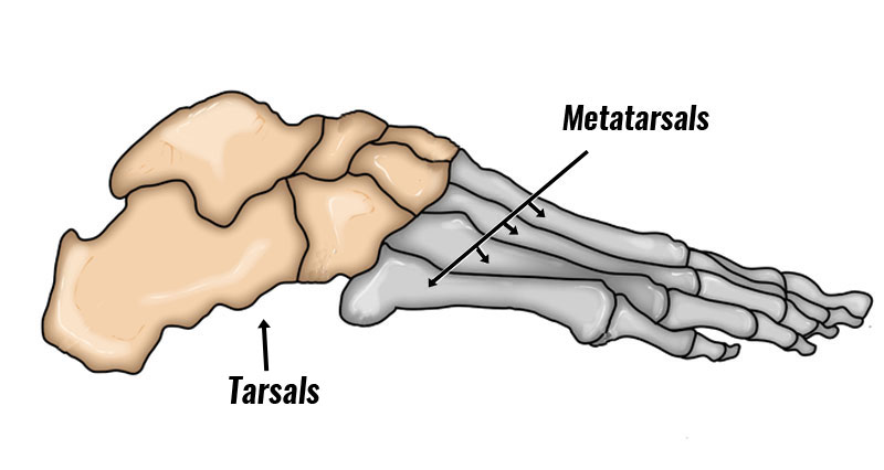 Tarsal bones - tarsal coalition