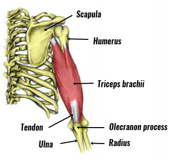 Triceps tendinopathy