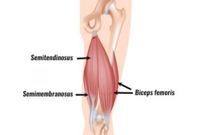 Hamstring Tendon Strain - Symptoms, Causes, Treatment & rehabilitation