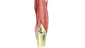 Hamstring tendon strain