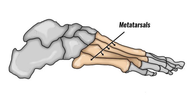 Metatarsal fractures