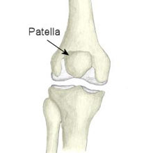Patellofemoral Instability