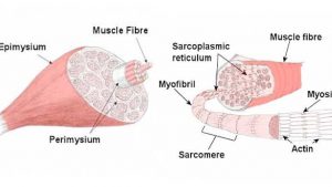 Muscle Strains