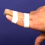 Finger buddy taping