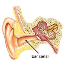 Swimmers Ear 