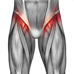 upper thigh pain