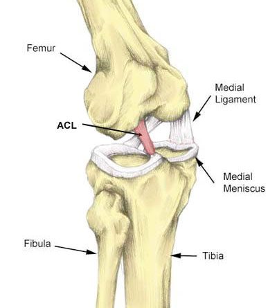 acl sprain