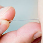 Acupuncture - Treatments and therapies 