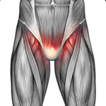 groin pain