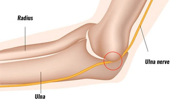 Ulna nerve