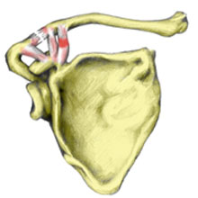 AC Joint Separation