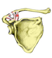 AC joint seperation sprain