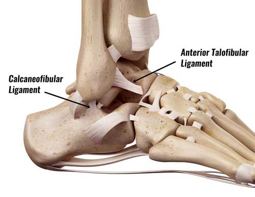 Ankle Sprain Ligaments