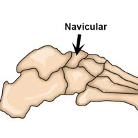 Navicular
