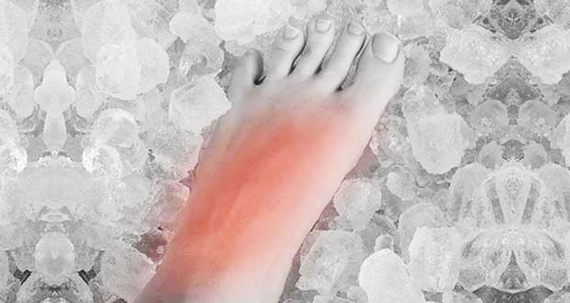 træner via udtryk Pain On Top Of The Foot - Injuries, Causes, Treatment & Exercises