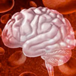 brain bleed