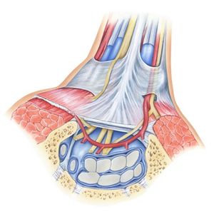 Carpal tunnel syndrome