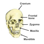 fractured skull