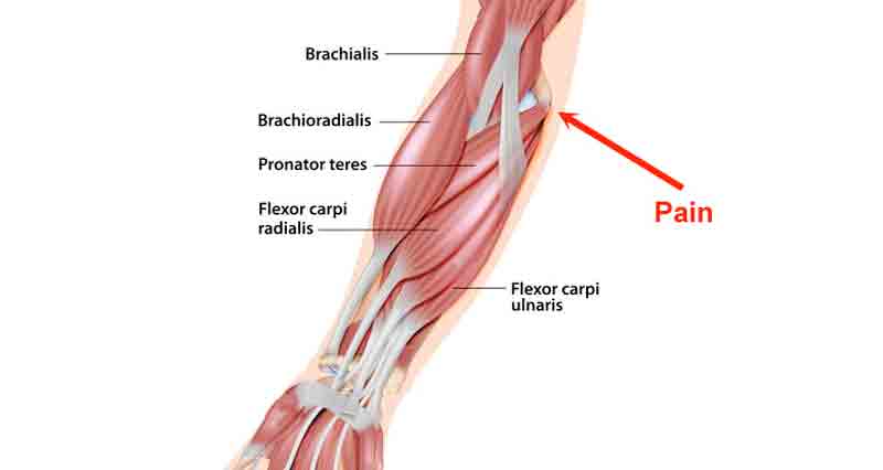 Golfers elbow anatomy