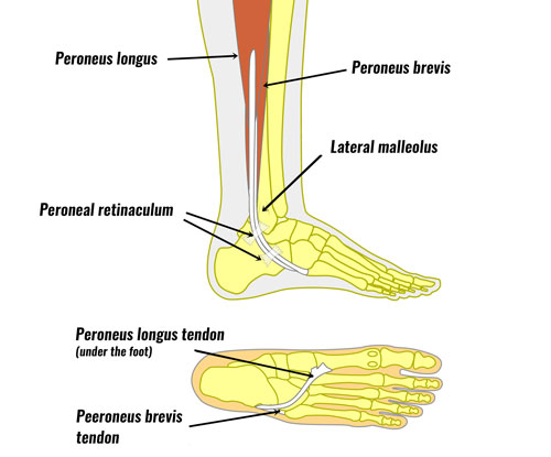 pain outside of achilles tendon