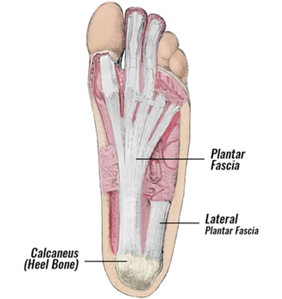 Plantar fascia strain clearance