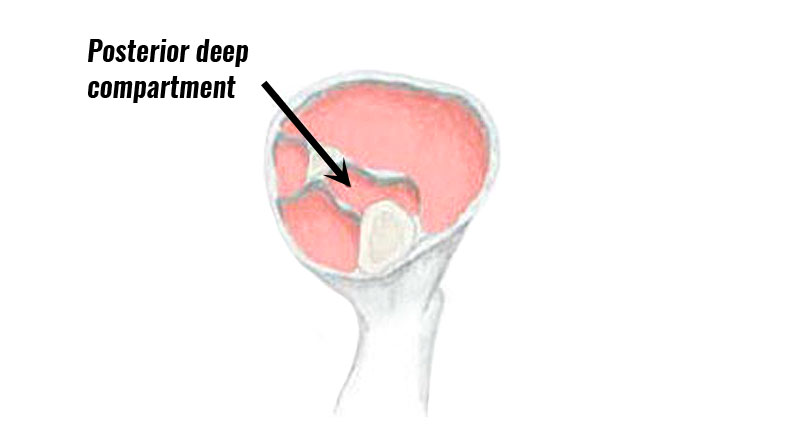 Posterior deep compartment